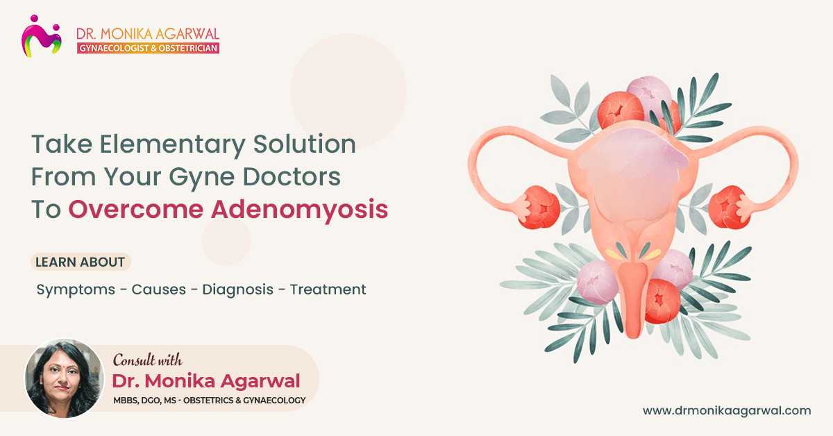 Take Elementary Solution From Your Gyne Doctors To Overcome Adenomyosis