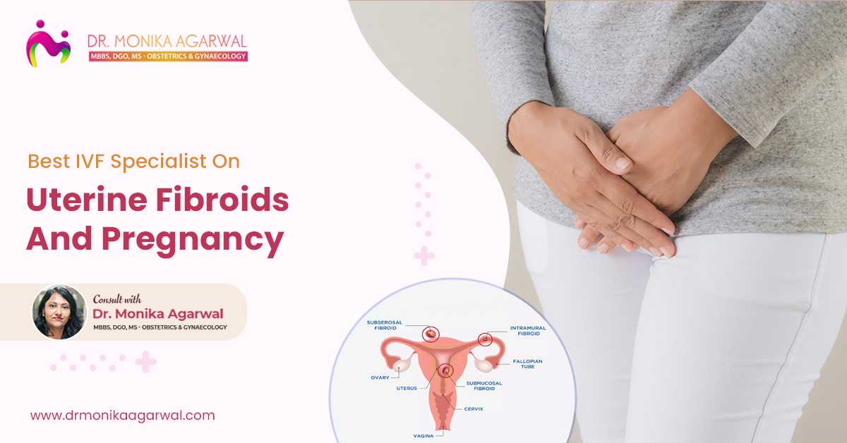 Best IVF Specialist On Uterine Fibroids And Pregnancy