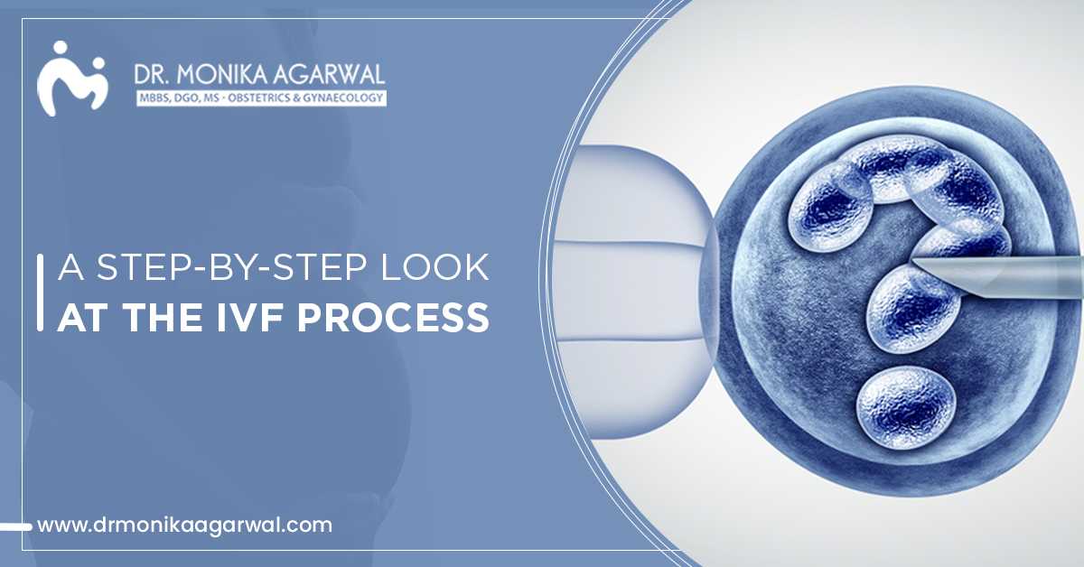 A Step By Step Look AT IVF Process